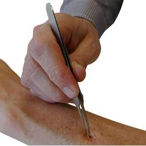 HypaGuard Tick Remover